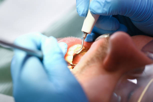 Best Weekend Emergency Dental Services in Knoxvle, IL