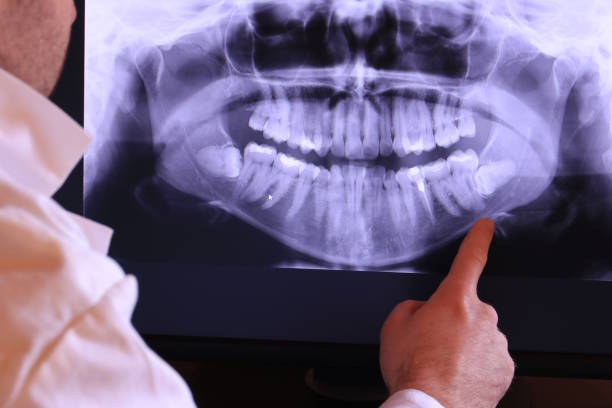 Best 24-Hour Emergency Dental Care in Knoxvle, IL