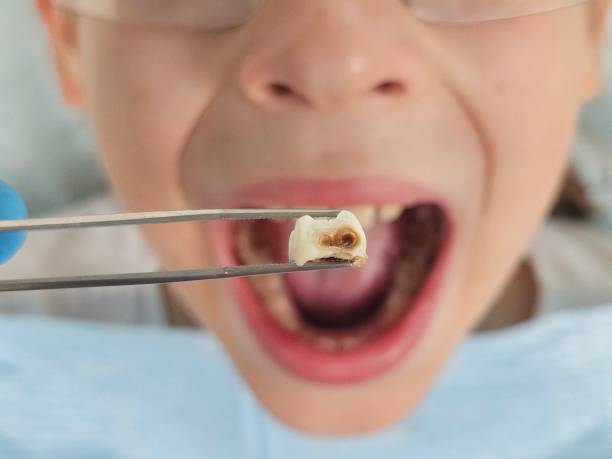 Best 24-Hour Emergency Dental Care in Knoxvle, IL